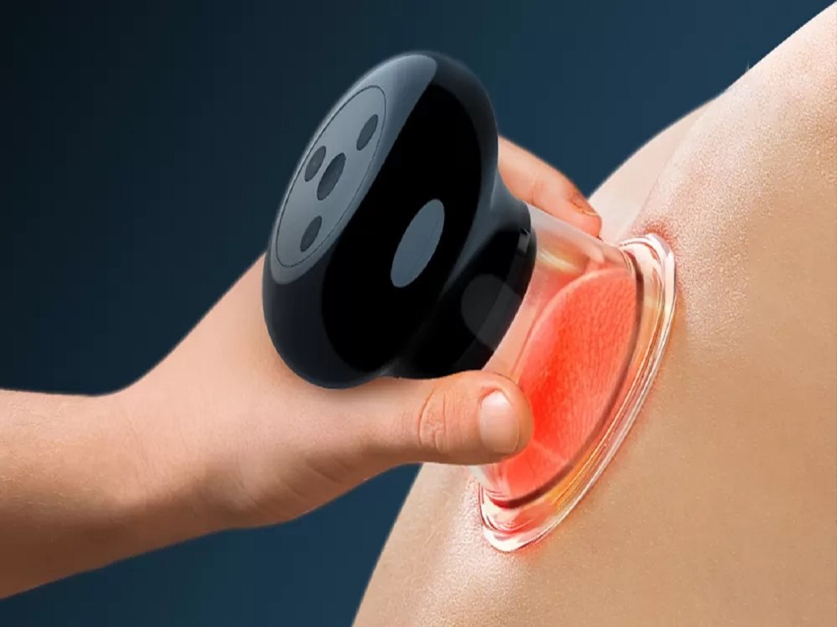 How to Perform Safe and Effective Cupping Therapy at Home: A Modern Guide