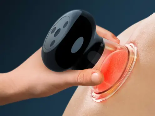 Electric Cupping Massager: Benefits, Functions, and How to Use Modern Cupping Technology